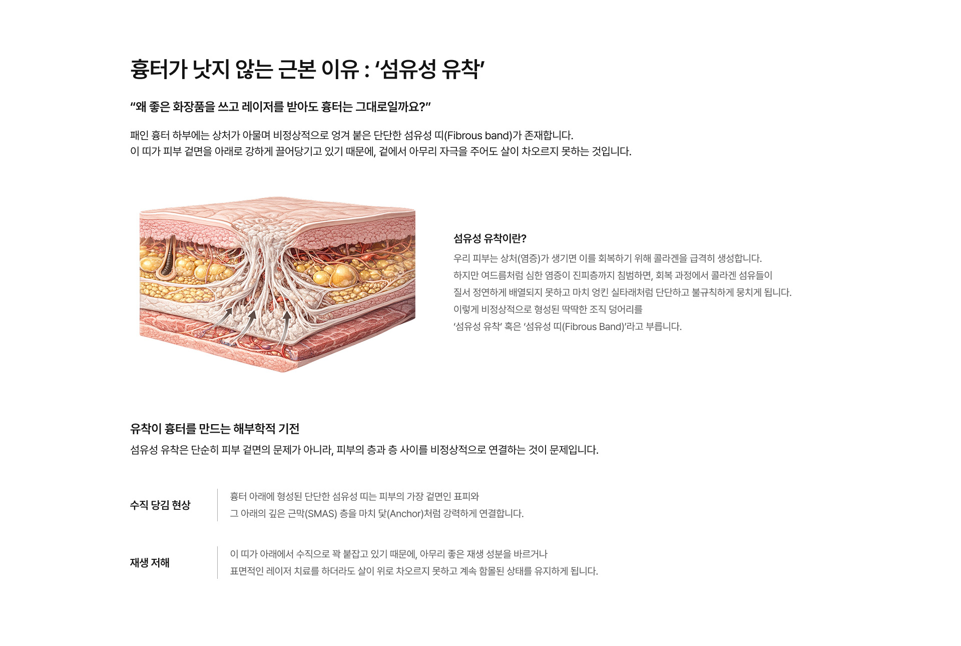 여드름 흉터 02