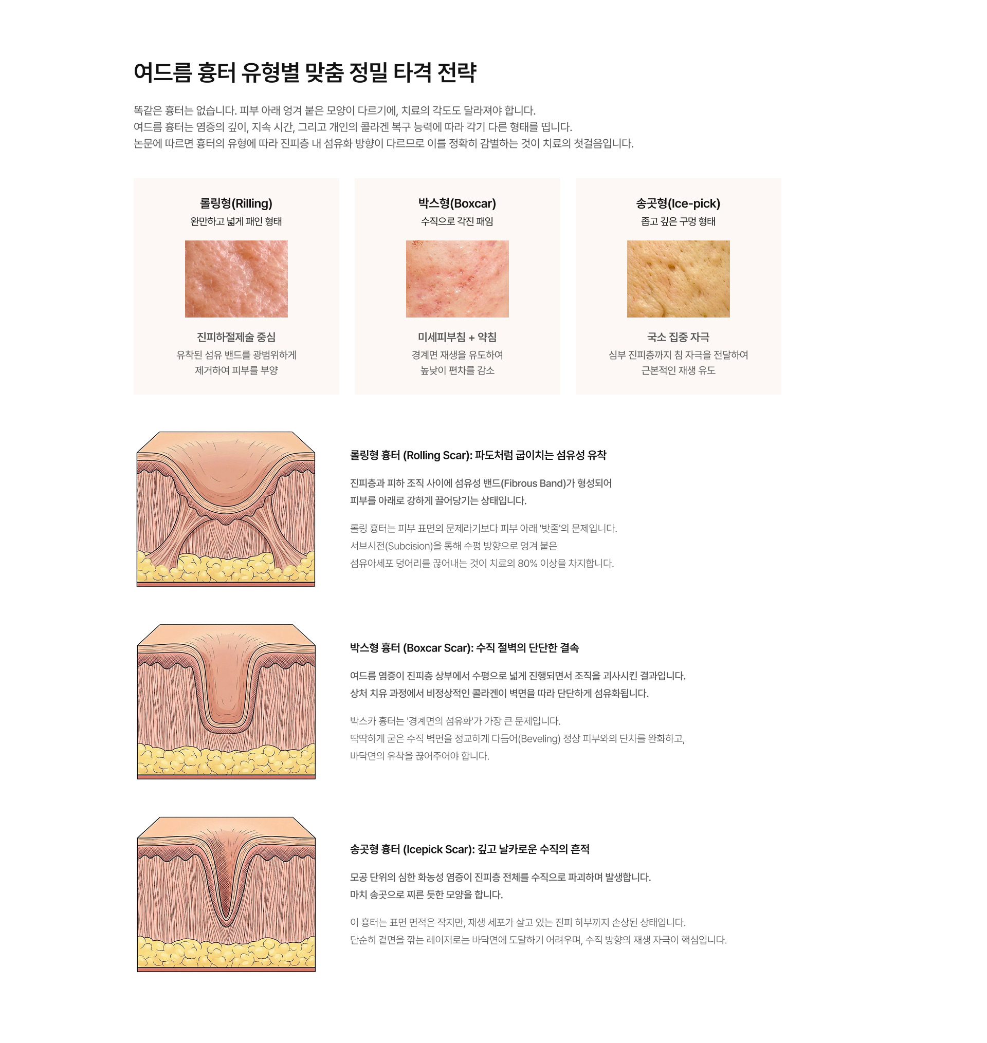 여드름 흉터 04