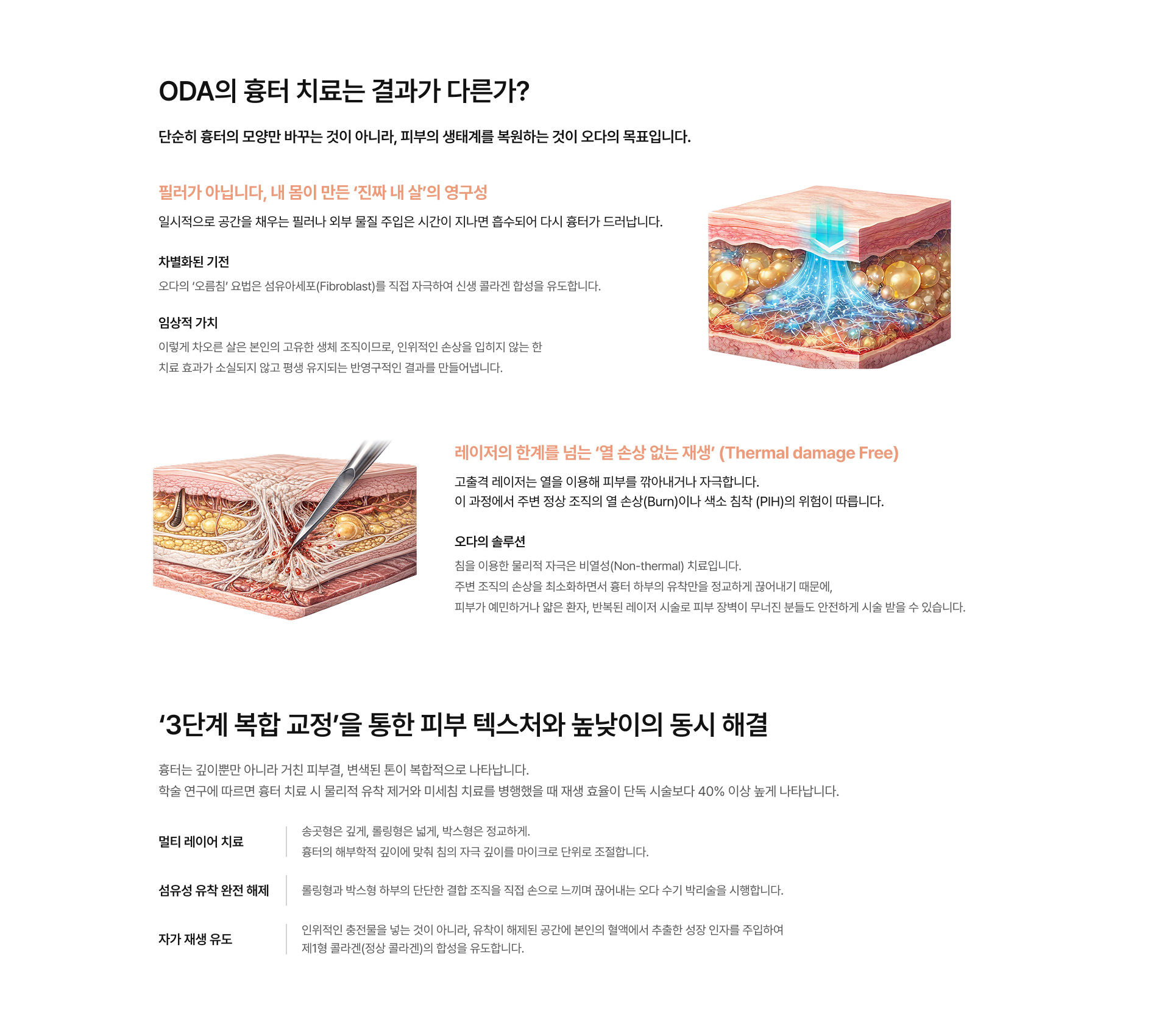 여드름 흉터 05