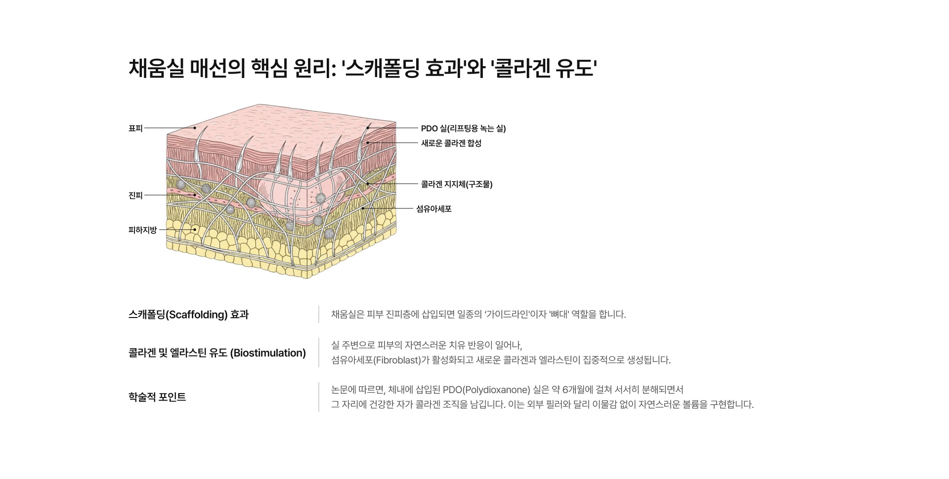 채움실 매선 02