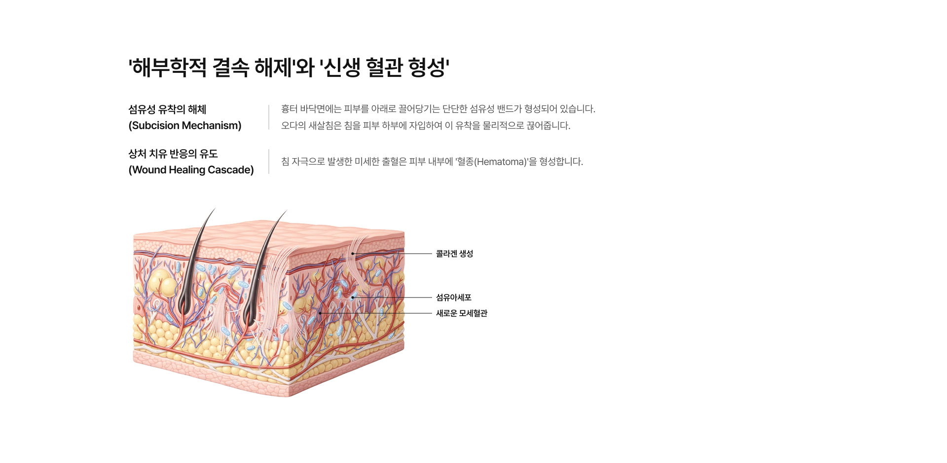 새살침 프로그램 02