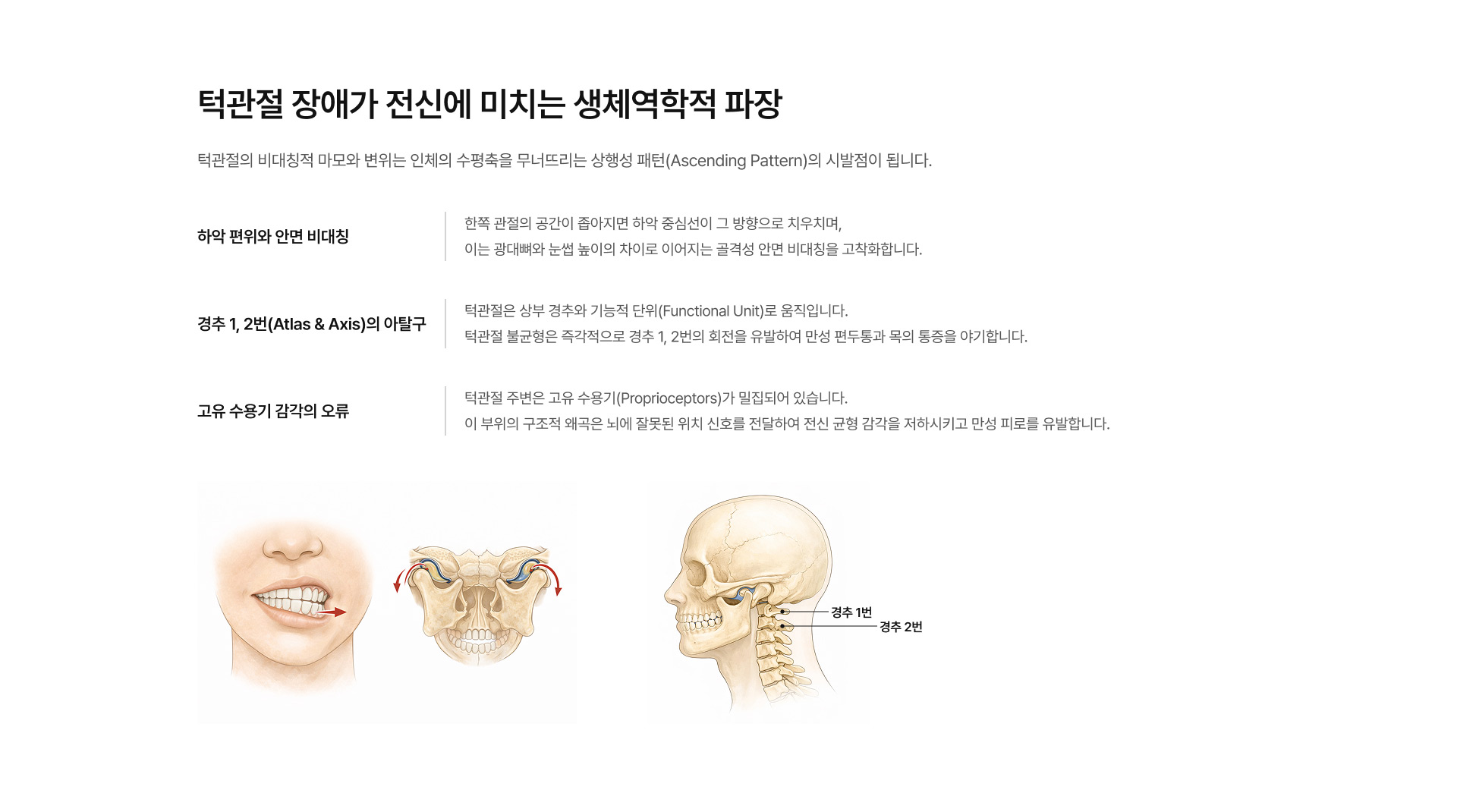 턱관절교정(통증/소리) 03