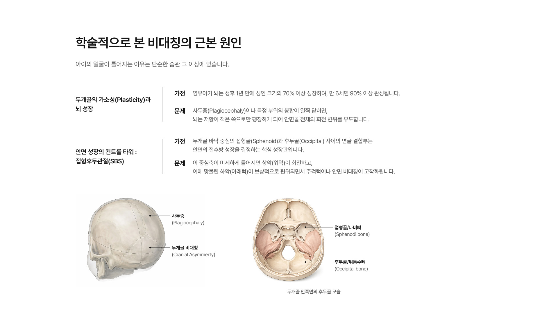 소아안면비대칭/두상교정 03