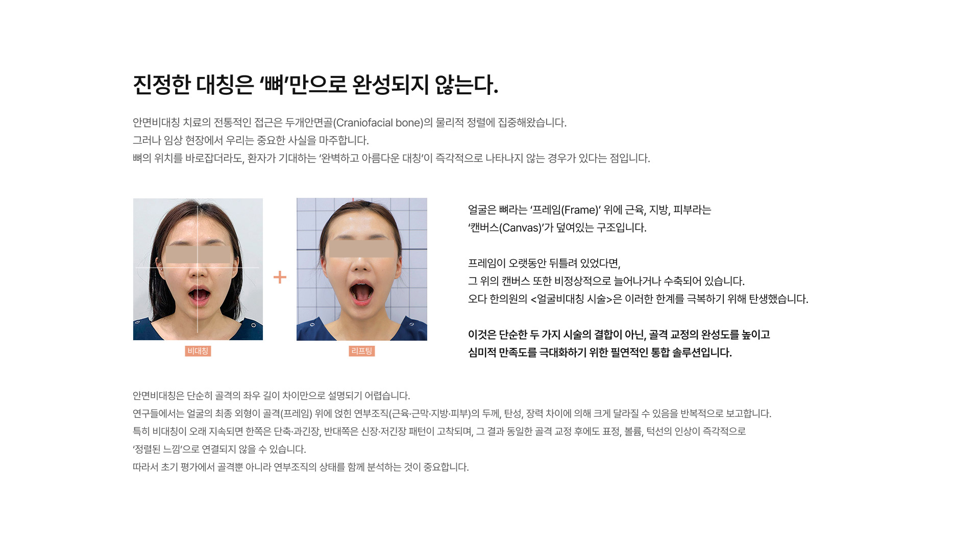얼굴비대칭 시술 01